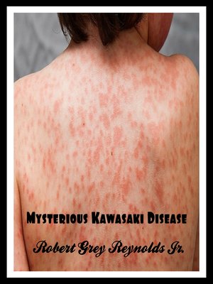 cover image of Mysterious Kawasaki Disease